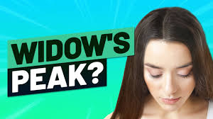 The name supposedly stems back to the 16th century, when widowers used to wear a peaked headdress after they lost their spouse. Widow S Peak Hairline How To Treat It And What Causes It Youtube