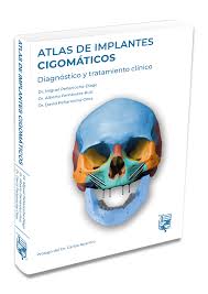 Libro de atlas 6 grado digital 2:46 medi4all 22 556 просмотров. Atlas De Implantes Cigomaticos Miguel Penarrocha Alberto Fernandez David Penarrocha Lisermed Editorial De Libros Medicos