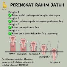 Justeru itu rahim akan jatuh ke bawah melalui saluran faraj. Bumil Hq Punca Rahim Jatuh Cara Mengelakkannya Di Facebook