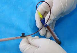 Studies have shown that cord blood processed within 12 hours of collection yields considerably more viable some doctors charge a small fee for the cord blood and cord tissue collection procedure. Repeated Blood Collection From Tail Vein Of Non Anesthetized Rats With A Vacuum Blood Collection System Protocol