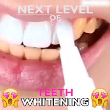 Pin On Whiten Teeth Naturally