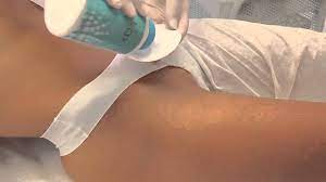 Citeste totul despre epilarea inghinala pas cu pas la tine acasa, ca sa scapi de drumurile pana la salon! Epilat Zona Inghinala Cu Ceara Film Elastica Italwax Youtube