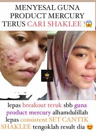 Disini saya himpunkan koleksi2 testimoni pengguna2 set kulit shaklee untuk rujukan uolls. Kulit Cantik Shaklee Pengedar Shaklee Shah Alam