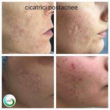 We did not find results for: Pete De La Cosuri Despre ViaÈ›a Din Romania