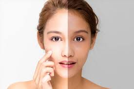 Best DeTan Cream: Shop Top Tan Removal Products – The Love Co