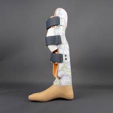 Angeborene Fehlbildungen Sanitatshaus Puttmann In Essen Stiefel Beine Fusse