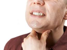 Difficulty swallowing, also known as dysphagia; Throat Ulcers Causes Symptoms And Treatment