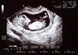 Ultraschalluntersuchung in der Schwangerschaft | swissmom