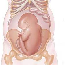 ters dogum belirtileri nelerdir gebe com