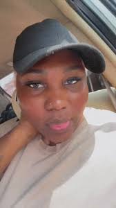 Thevitiligogirl (@iamaderinsola4)