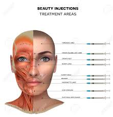 Thousands, or even tens of thousands, of small fibers make up each muscle. Beauty Aesthetic Injections Treatment Areas Muscles Structure Of The Female Face And Neck Each Muscle With Name On It Royalty Free Cliparts Vectors And Stock Illustration Image 140984861