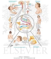 Image result for Galactorrhea