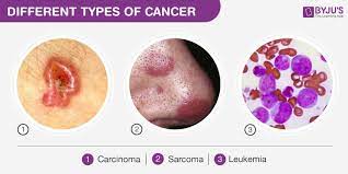 But, ccs can grow throughout the torso, including the stomach and intestines. Types Of Cancer Symptoms Causes And Treatment