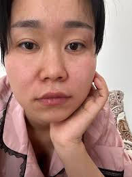 Hi I'm looking for someone who can help improve our SEO and knows the  cosmetics/skin/injectables industry. Someone with proven results please.