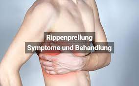 Rippenprellung Symptome Behandlung Dauer Praktischarzt