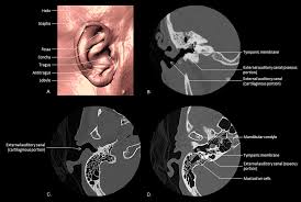 External ear middle ear (cleft) inner ear 3. Epos Trade