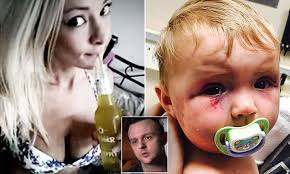 Father of baby who was bashed by mother speaks of injuries