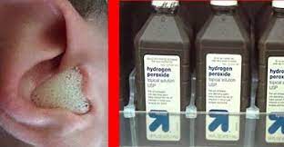 The rules for cleaning a pet's ears are not cast on stone. How To Clean Ears With Hydrogen Peroxide Earbudsz