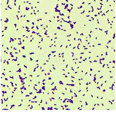 By 2020, 21 species had been identified. Microscopic Examination Of Listeria Monocytogenes With Gram Stain Of Download Scientific Diagram