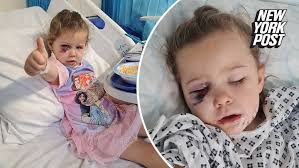 3-year-old attacked by dog while