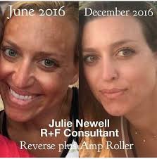 Rodan and Fields Skin Care: Mary Hammack, Independent Consultant