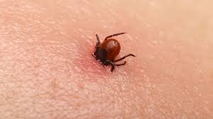 After the tick has been removed, wash the area of the tick bite with a lot of warm, clean water. Ticks What You Need To Know Cnn