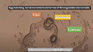 Image result for Strongyloides