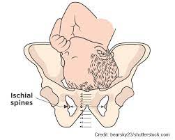 Fetal Station Maternity Nursing