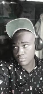 Rip bamenda nous prend encore un jeune policier de 22ans Le nozo à encore  frappé sur nos policier les 2 autres sont blessés