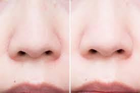 Biore Charcoal Pore Strips Before And After Beauty Daily Face Moisturizer Pore Refiner Face Mask For Pores