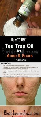 Pin On Overnight Acne Mask