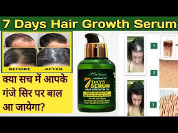 Great product hair serum to improve hair density i buy it repeatedly! 7 Day Serum Best Hair Growth Serum Dr Sahas Aromayuth 7 Day Serum Review Rolis Life Style Youtube