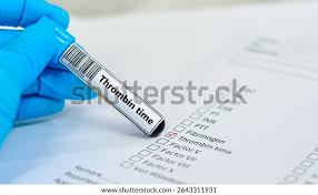 Image result for Thrombin Time