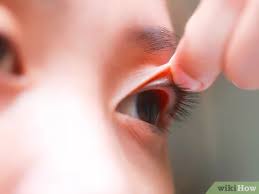 600 x 449 jpeg 27 кб. 3 Ways To Flip Eyelids Inside Out Wikihow