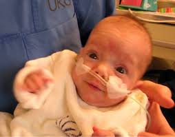 Klingt blöd, aber ich denke ab der 26.ten woche ist es lebensfähig, allerdings gibt es da dann noch immer risiken. Medizinische Besonderheit 300 Gramm Leichtes Baby Uberlebt Ohne Komplikationen Gesundheit Faz