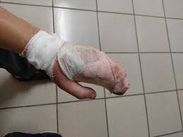 Укус кошки | Пикабу