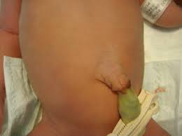 Image result for Umbilicus botryoides