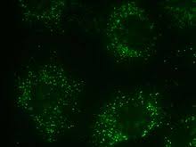 We did not find results for: Peroxisome Wikipedia