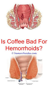 Pin On Hemorrhoid Relief