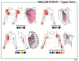 trigger point referral patterns balance in motion bodywork