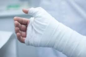 Image result for Hand Injury