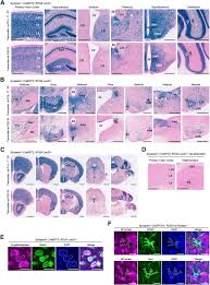 We did not find results for: Induction Of Mutant Sik3sleepy Allele In Neurons In Late Infancy Increases Sleep Need Journal Of Neuroscience