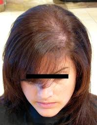 Quelle Coiffure Pour Des Cheveux Fins