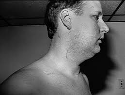 Forensic Files" All Wet (TV Episode 2003)