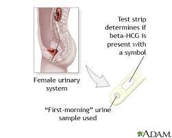 Pregnancy Test Vancouver Sun