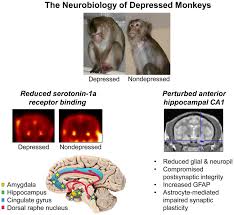 Samantha browne was forced into a life of prostitution. The Impact Of Treatment With Selective Serotonin Reuptake Inhibitors On Primate Cardiovascular Disease Behavior And Neuroanatomy Abstract Europe Pmc