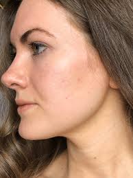 StriVectin 4 Week Skin Reset