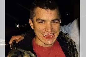 Fundraiser by Sylvia Peach : Teeth for tyde balmes