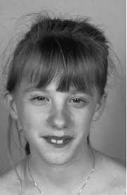 Short Children Born Small for Gestational Age (SGA)