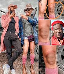 Bahumi's fans were confused on the 5th of april after she posted a picture on her instagram account. Somizi S Knee Causes Chaos On Social Media Sa411